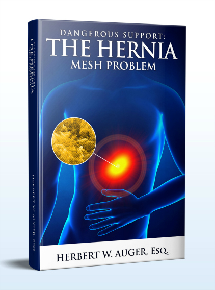Hernia Mesh Book