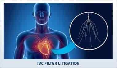 IVC filter litigation