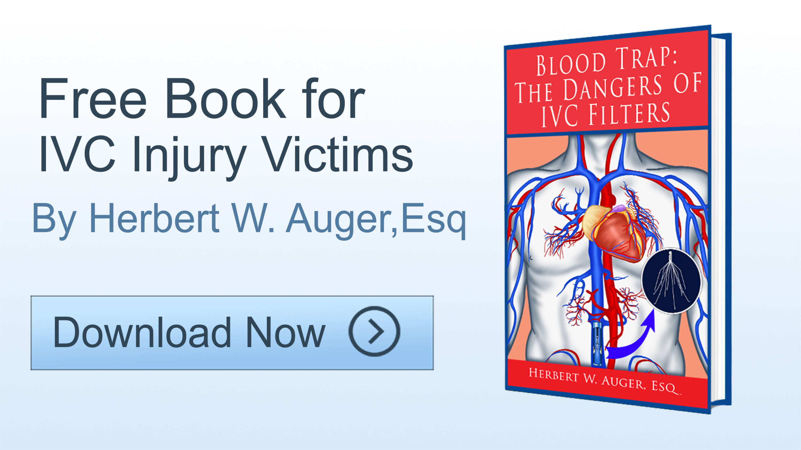 Download free eBook for IVC injury victims